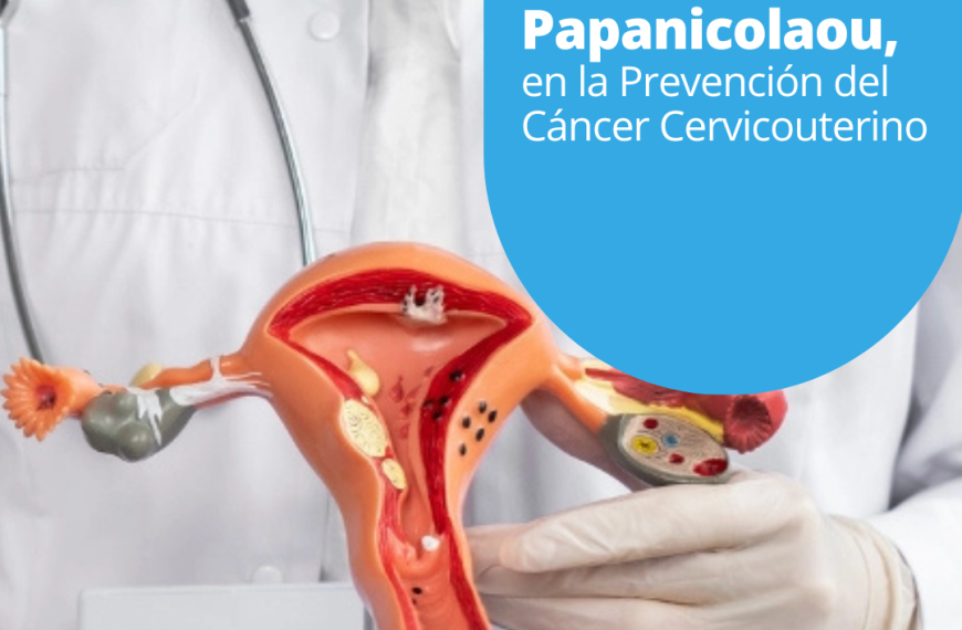 Importancia de la Prueba de Papanicolaou en la Prevención del Cáncer Cervicouterino