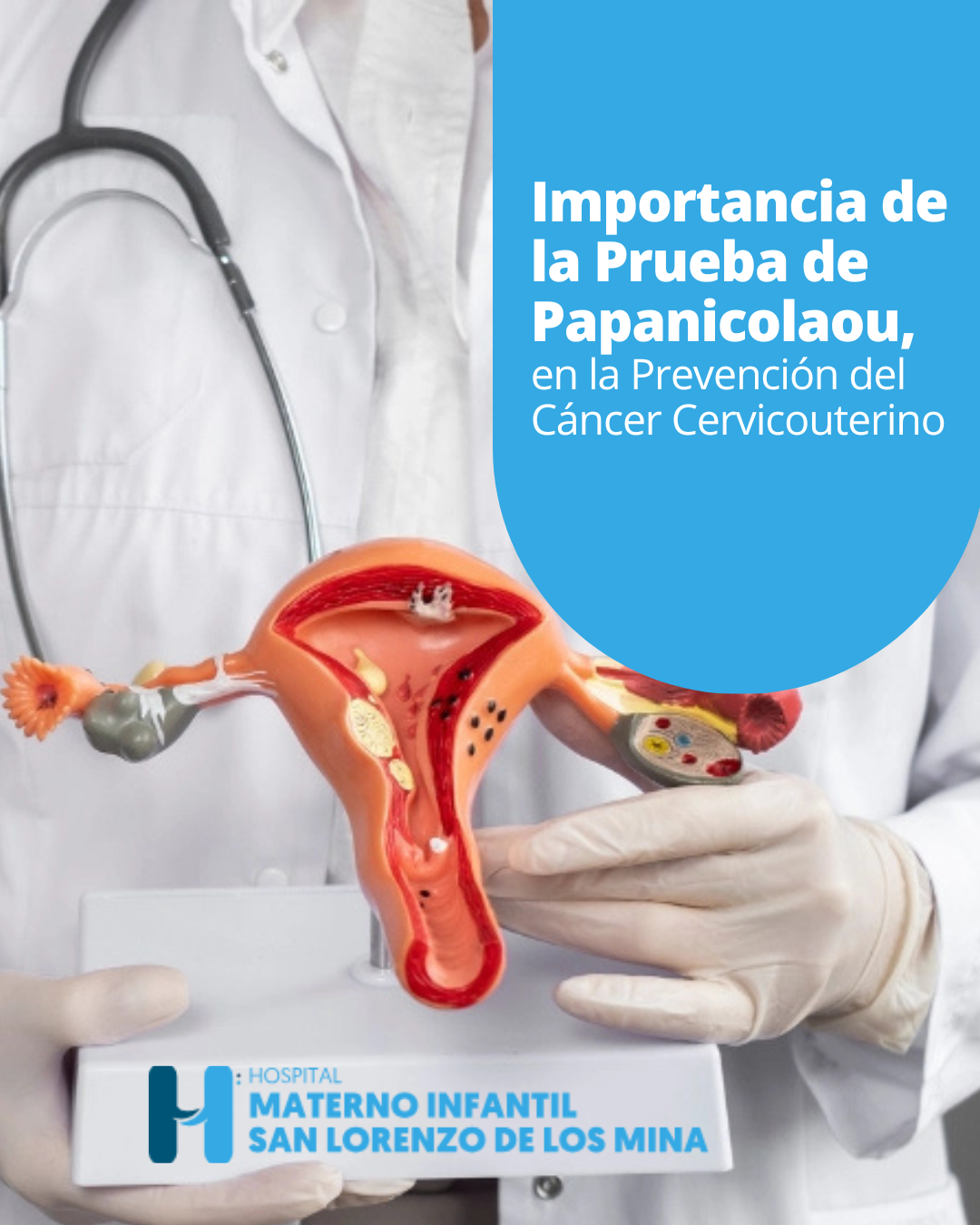 You are currently viewing <strong>Importancia de la Prueba de Papanicolaou en la Prevención del Cáncer Cervicouterino</strong>